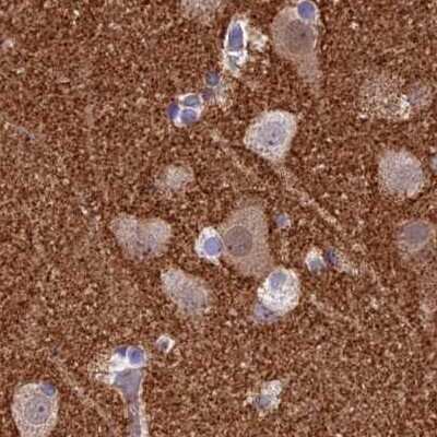 Immunohistochemistry-Paraffin: AP180 Antibody [NBP1-90146]
