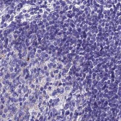 Immunohistochemistry-Paraffin: AP180 Antibody [NBP1-90146]