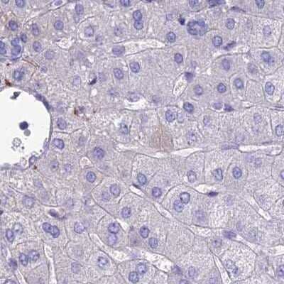 Immunohistochemistry-Paraffin: AP180 Antibody [NBP1-90146]