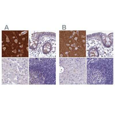 Immunohistochemistry-Paraffin: AP180 Antibody [NBP1-90147]