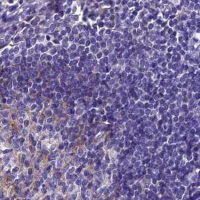 Immunohistochemistry-Paraffin: AP180 Antibody [NBP1-90147]
