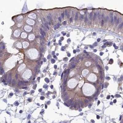 Immunohistochemistry-Paraffin: AP180 Antibody [NBP1-90147]