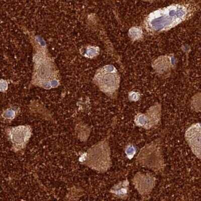 Immunohistochemistry-Paraffin: AP180 Antibody [NBP1-90147]