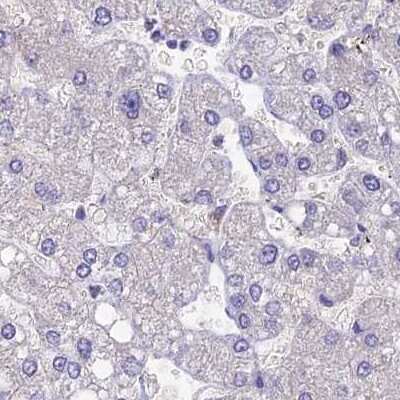 Immunohistochemistry-Paraffin: AP180 Antibody [NBP1-90147]
