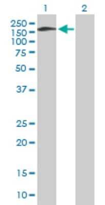 Western Blot: AP180 Antibody [H00009892-B01P]