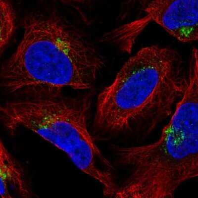 Immunocytochemistry/ Immunofluorescence: AP1AR Antibody [NBP2-58664]