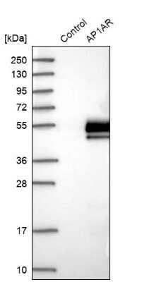 Western Blot: AP1AR Antibody [NBP1-90879]