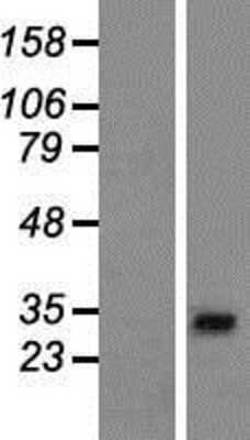 Western Blot: AP1AR Overexpression Lysate [NBP2-06788]