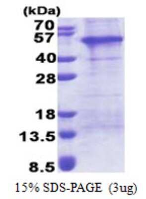 SDS-PAGE: Recombinant Human AP1AR His Protein [NBP2-22677]