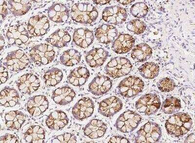 Immunohistochemistry-Paraffin: AP1G2 Antibody [NBP3-05786]