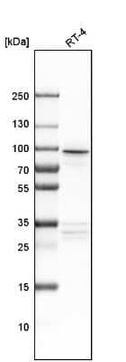 Western Blot: AP1G2 Antibody [NBP1-81857]