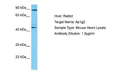 Western Blot: AP1G2 Antibody [NBP2-82632]