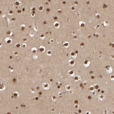 Immunohistochemistry-Paraffin: AP1GBP1 Antibody [NBP1-90144]