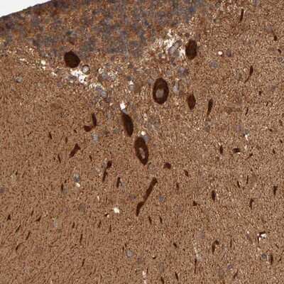 Immunohistochemistry-Paraffin: AP1GBP1 Antibody [NBP1-90145]