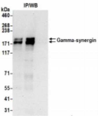 Immunoprecipitation: AP1GBP1 Antibody [NBP2-36531]