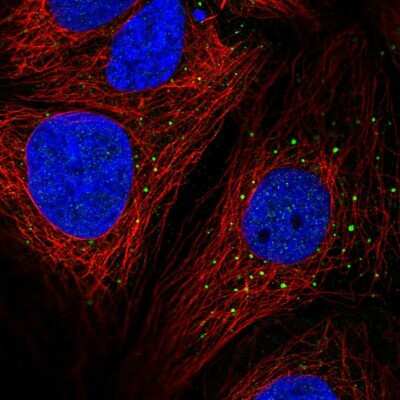 Immunocytochemistry/ Immunofluorescence: AP1M2 Antibody [NBP2-55000]