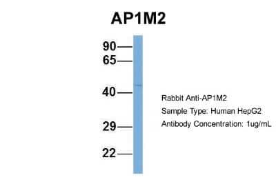 Western Blot: AP1M2 Antibody [NBP1-57035]