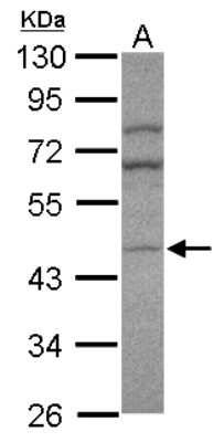 Western Blot: AP1M2 Antibody [NBP2-15415]