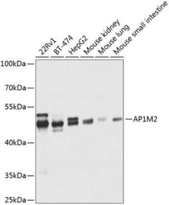 Western Blot: AP1M2 AntibodyBSA Free [NBP2-92832]