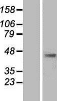 Western Blot: AP1M2 Overexpression Lysate [NBP2-07741]