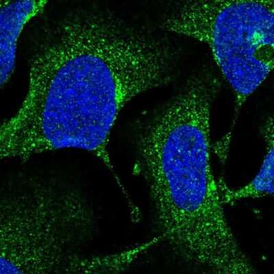 Immunocytochemistry/ Immunofluorescence: AP1S1 Antibody [NBP2-46862]