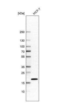 Western Blot: AP1S1 Antibody [NBP2-46862]