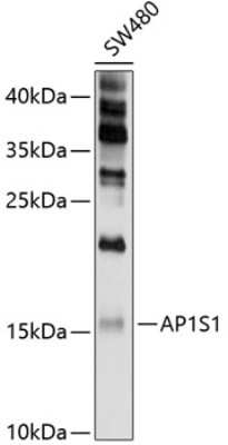 Western Blot: AP1S1 AntibodyBSA Free [NBP2-92032]