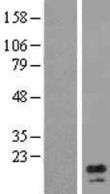 Western Blot: AP1S1 Overexpression Lysate [NBL1-07577]