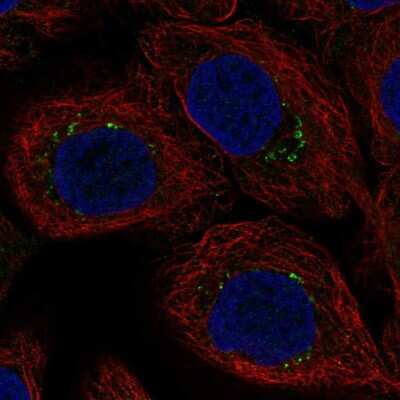 Immunocytochemistry/ Immunofluorescence: AP1S3 Antibody [NBP2-49493]