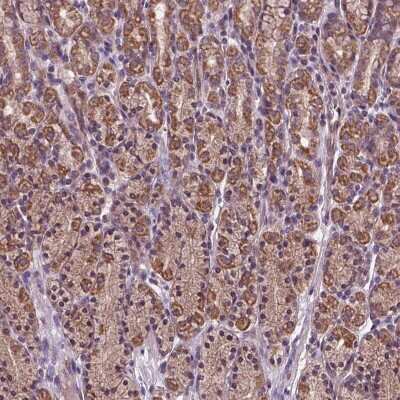 Immunohistochemistry-Paraffin: AP1S3 Antibody [NBP2-49493]
