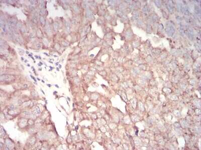 Immunohistochemistry-Paraffin: AP2 alpha Antibody (7D2B5) - BSA Free [NBP2-52572]