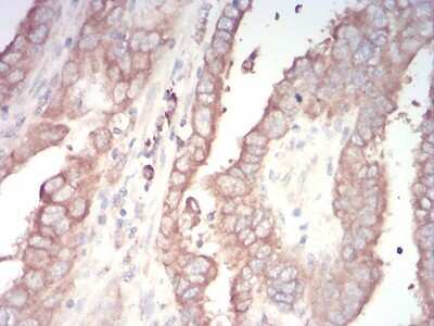 Immunohistochemistry-Paraffin: AP2 alpha Antibody (7D2B5) - BSA Free [NBP2-52572]