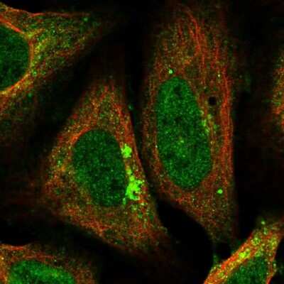 Immunocytochemistry/ Immunofluorescence: AP2 alpha Antibody [NBP1-90143]