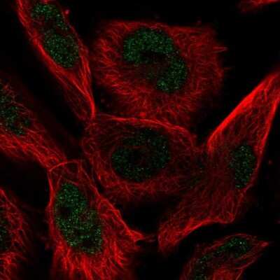 Immunocytochemistry/ Immunofluorescence: AP2 alpha Antibody [NBP2-38809]