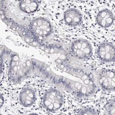 Immunohistochemistry-Paraffin: AP2 alpha Antibody [NBP1-90143]