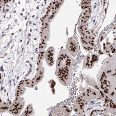 Immunohistochemistry-Paraffin: AP2 alpha Antibody [NBP1-90143]