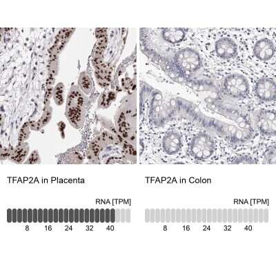 Immunohistochemistry-Paraffin: AP2 alpha Antibody [NBP1-90143]