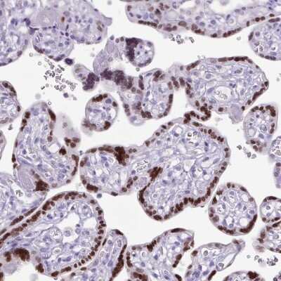 Immunohistochemistry-Paraffin: AP2 alpha Antibody [NBP2-38809]