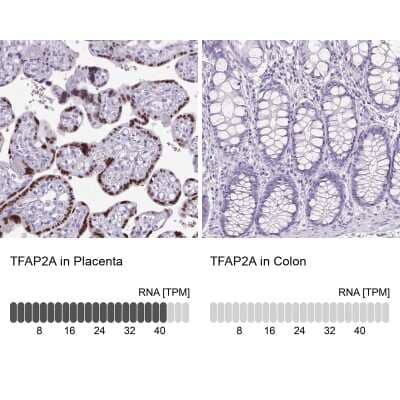 Immunohistochemistry-Paraffin: AP2 alpha Antibody [NBP2-38809]