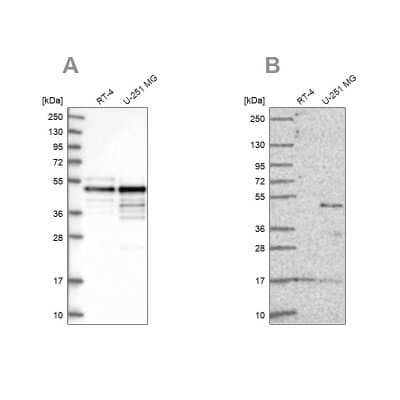 Western Blot: AP2 alpha Antibody [NBP1-90143]