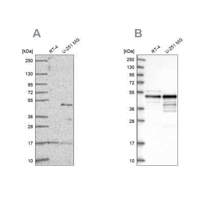 Western Blot: AP2 alpha Antibody [NBP2-38809]