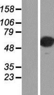 Western Blot: AP2 alpha Overexpression Lysate [NBP2-11607]