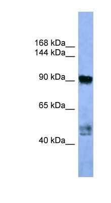 Western Blot: AP2A2 Antibody [NBP1-68948]