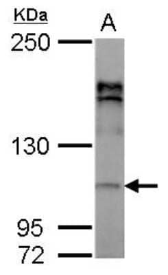 Western Blot: AP2A2 Antibody [NBP2-15417]