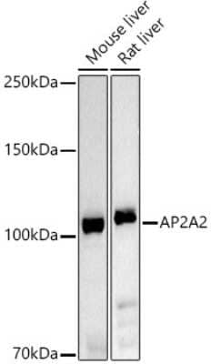 Western Blot: AP2A2 AntibodyAzide and BSA Free [NBP2-92458]