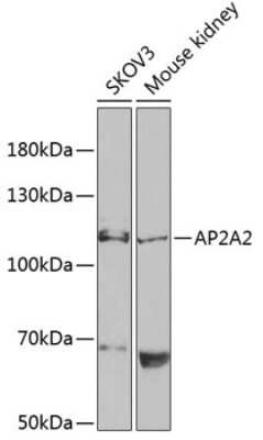 Western Blot: AP2A2 AntibodyBSA Free [NBP2-92716]