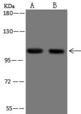 Western Blot: AP2A2 Antibody [NBP3-12692]