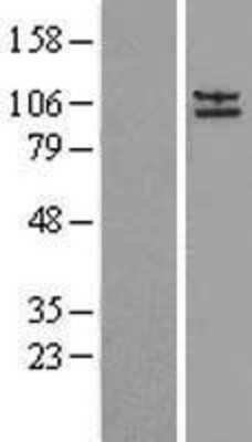 Western Blot: AP2A2 Overexpression Lysate [NBL1-07578]