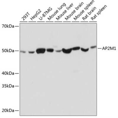 Western Blot: AP2M1 Antibody (10J8D1) [NBP3-15341]