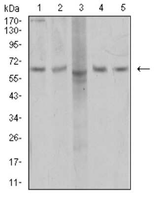 Western Blot: AP2M1 Antibody (4F1B2)BSA Free [NBP2-61866]